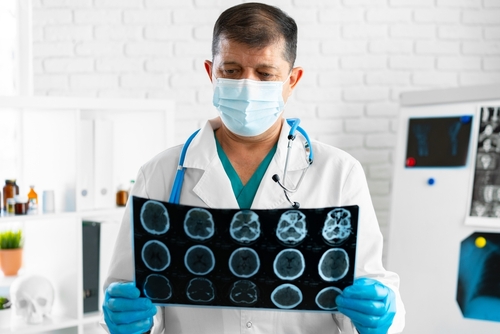 A doctor holding a brain scan